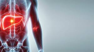 ಈ 4 ಆಹಾರಗಳು ಯಕೃತ್ತಿಗೆ ವಿಷ! ಲಿವರ್ ಕ್ಯಾನ್ಸರ್ ಅಪಾಯ ಹೆಚ್ಚಿಸಲು ಕಾರಣವಾಗುವ ಆಹಾರಗಳ ಪಟ್ಟಿ